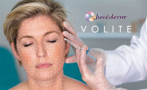 juvederm volite.